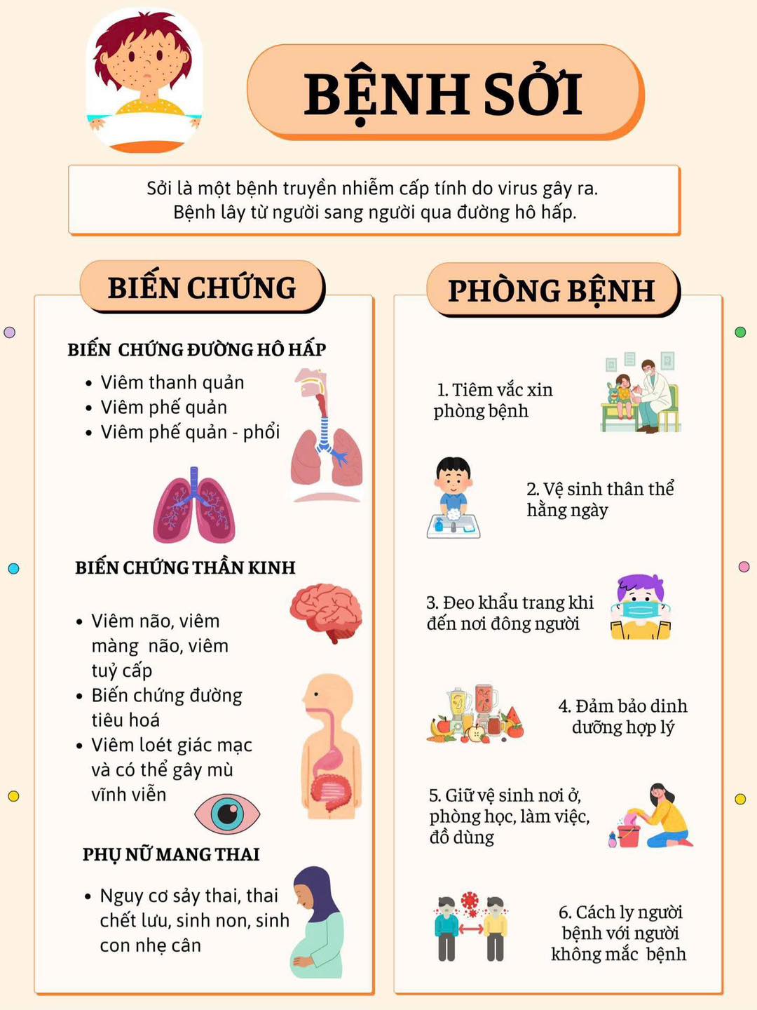 Bệnh Sởi 